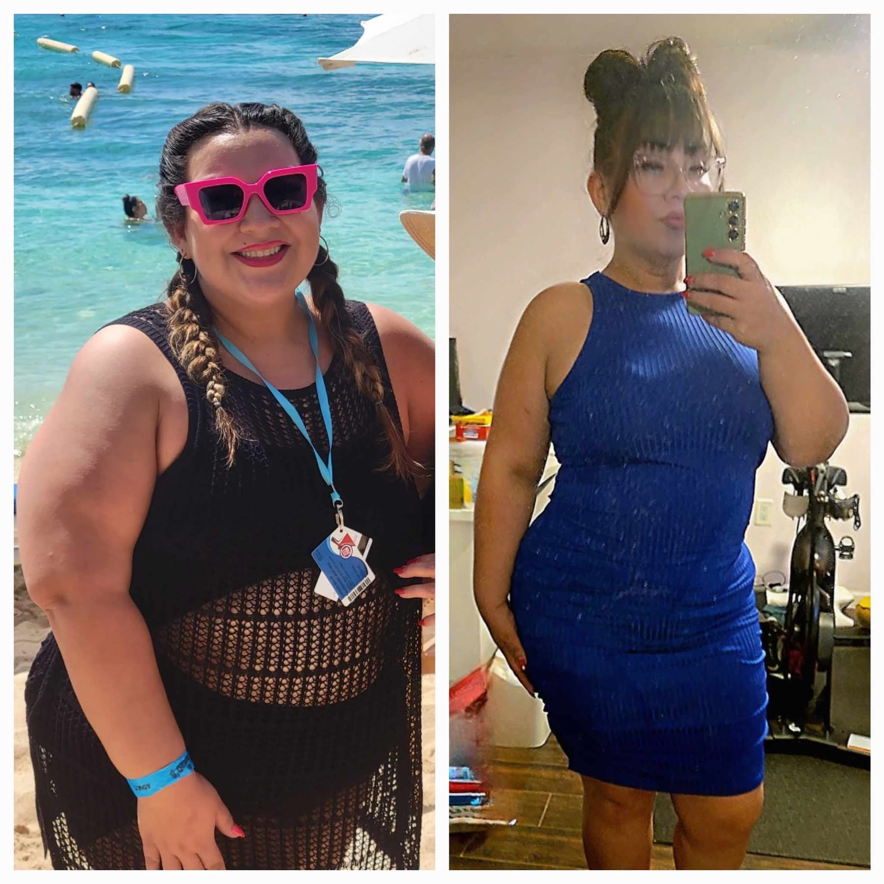 Actual patient transformation, before and after