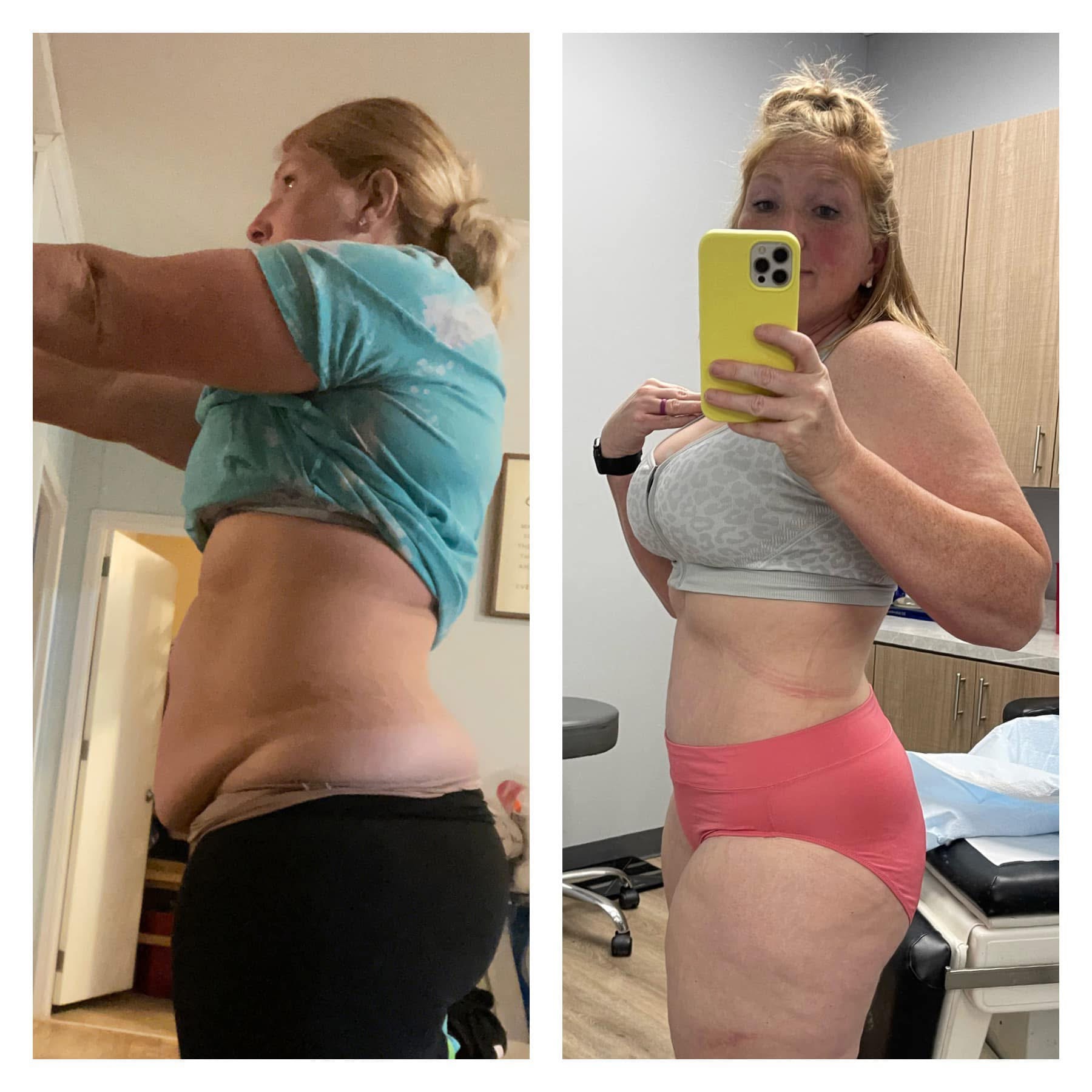 Actual patient transformation, before and after