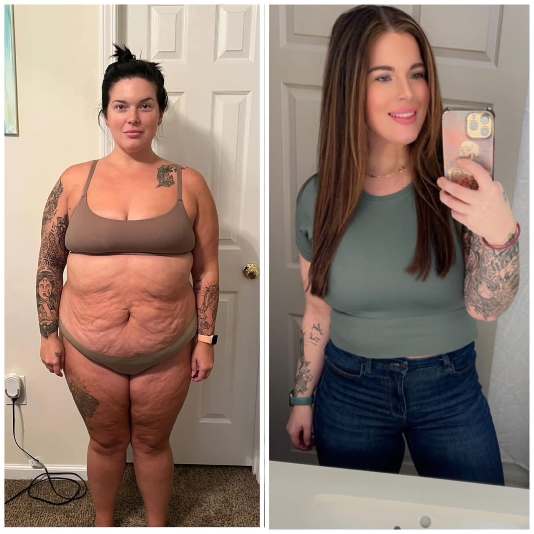 Actual patient transformation, before and after